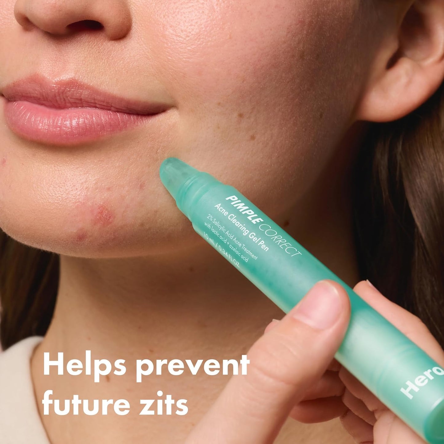 Hero_Cosmetics_Pimple_Correct_Acne_Clearing_Gel_Pen_-_Maximum_Strength_2%_Salicylic_Acid,_Derm-Tested_Formula_for_Current_and_Future_Zits_(1_Count)