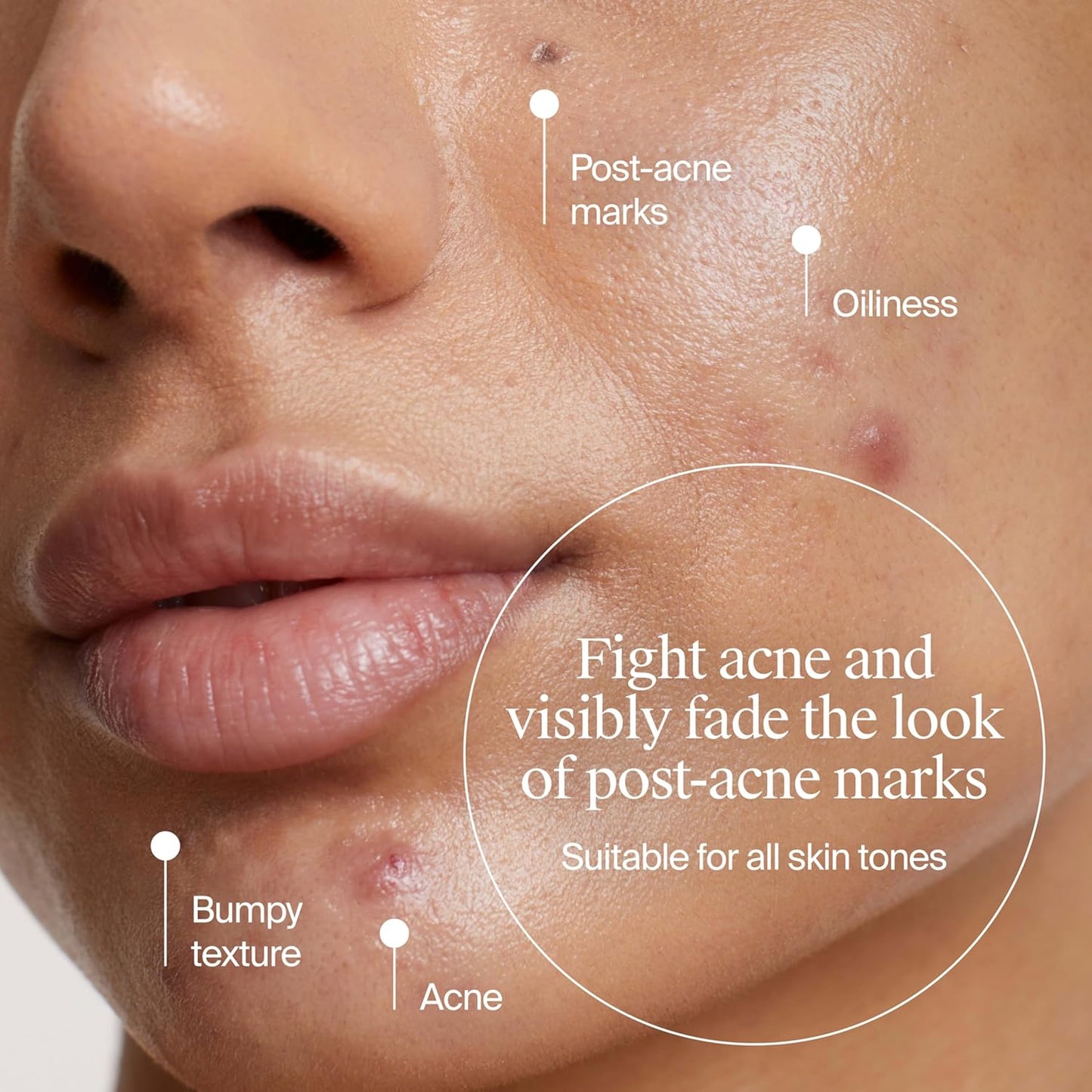 Neutrogena_Evenly_Clear_Acne_Cleanser_with_2%_Salicylic_Acid_&_2%_PHA_Exfoliant,_Gentle_Foaming_Face_Wash_Clears_Clogged_Pores_&_Blackheads_While_Visibly_Fading_Look_of_Post-Acne_Marks,_9.1_fl._oz