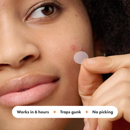 Mighty_Patch™_Variety_Pack_from_Hero_Cosmetics_-_Hydrocolloid_Acne_Pimple_Patches_for_Covering_Zits_and_Blemishes,_Spot_Stickers_for_Face_and_Skin,_Korean_Skin_Care,_26_ct