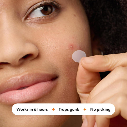 Mighty_Patch™_Variety_Pack_from_Hero_Cosmetics_-_Hydrocolloid_Acne_Pimple_Patches_for_Covering_Zits_and_Blemishes,_Spot_Stickers_for_Face_and_Skin,_Korean_Skin_Care,_26_ct