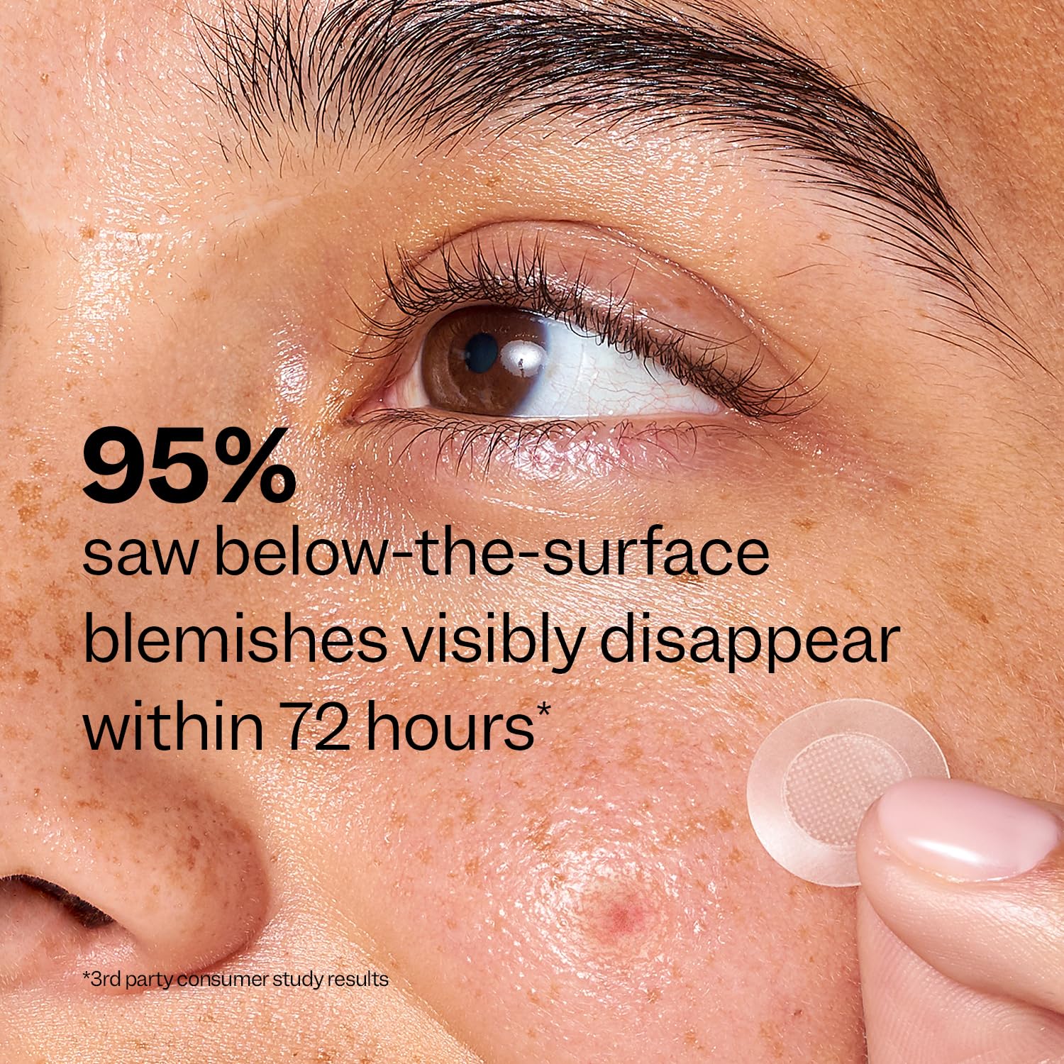 Peach_Slices_-_Deep_Blemish_Microdarts_(9_ct)_-_Early_Stage_Pimple_Patches_for_Face_-_Salicylic_Acid,_Niacinamide,_Hyaluronic_Acid,_Tea_Tree_Oil_&_Cica_-_Vegan,_Cruelty_Free,_Korean_Skin_Care_&_Beauty_|_Salicylic_Acid