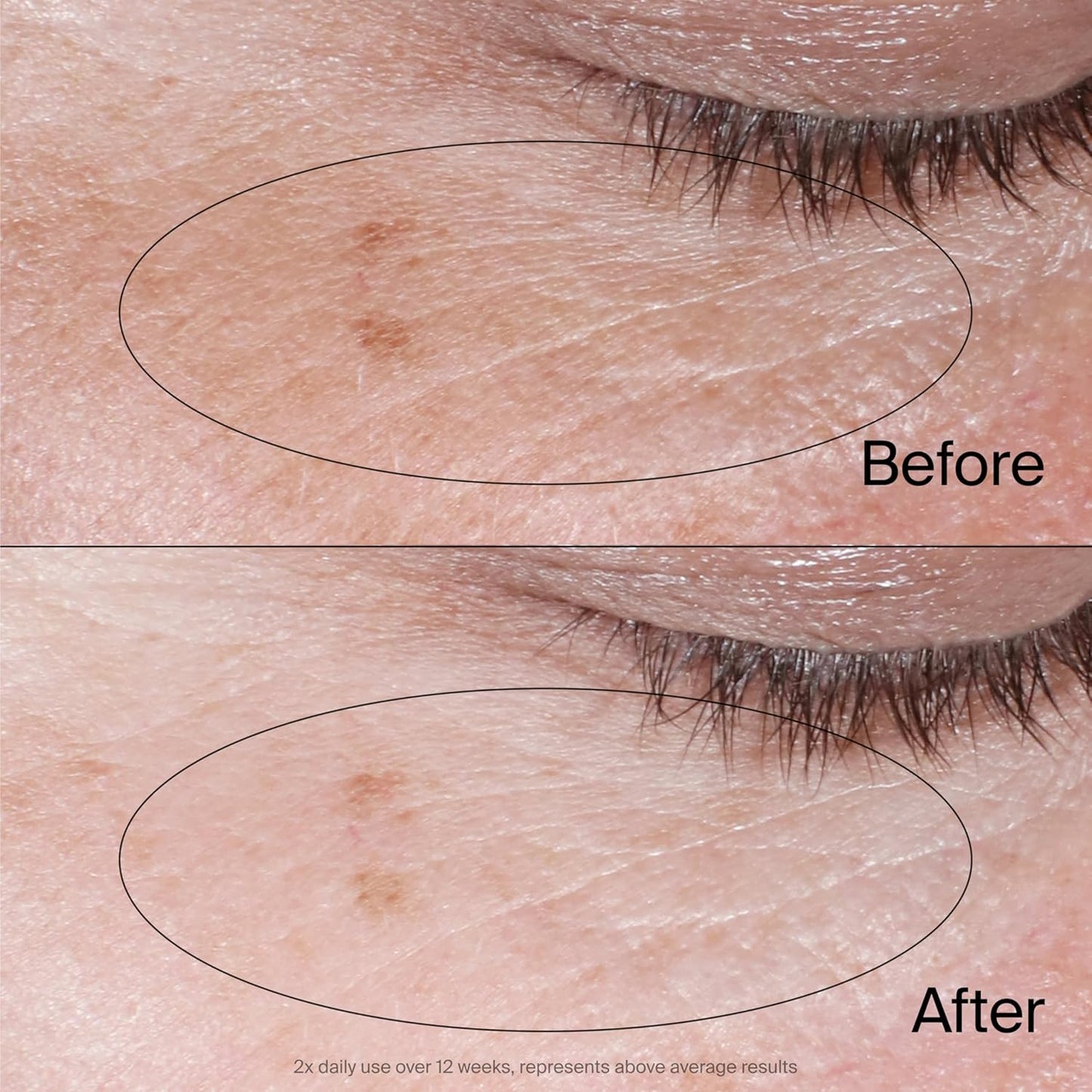 Neutrogena_Collagen_Bank_Reviving_Eye_Cream,_Under_Eye_Cream,_Helps_Preserve_Collagen,_Visibly_Improves_Dark_Circles,_Puffiness,_Fine_Lines,_Texture,_Fragrance_Free,_with_Peptides_0.5_oz