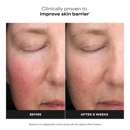 Paula’s_Choice_6%_Mandelic_Acid_+_2%_Lactic_Acid_Exfoliant,_Gentle_Daily_AHA_Exfoliation_for_Discoloration,_Bumpy_Texture_&_Radiance,_for_Sensitive_Skin,_Fragrance-Free