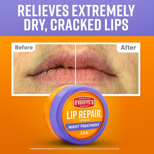 O'Keeffe's_Lip_Repair_Night_Treatment_Lip_Balm_for_Dry,_Cracked_Lips_-_0.25_Ounce_Jar_(1_Pack)_-_Moisturizer_Extremely_Cracked,_Dry_Lips