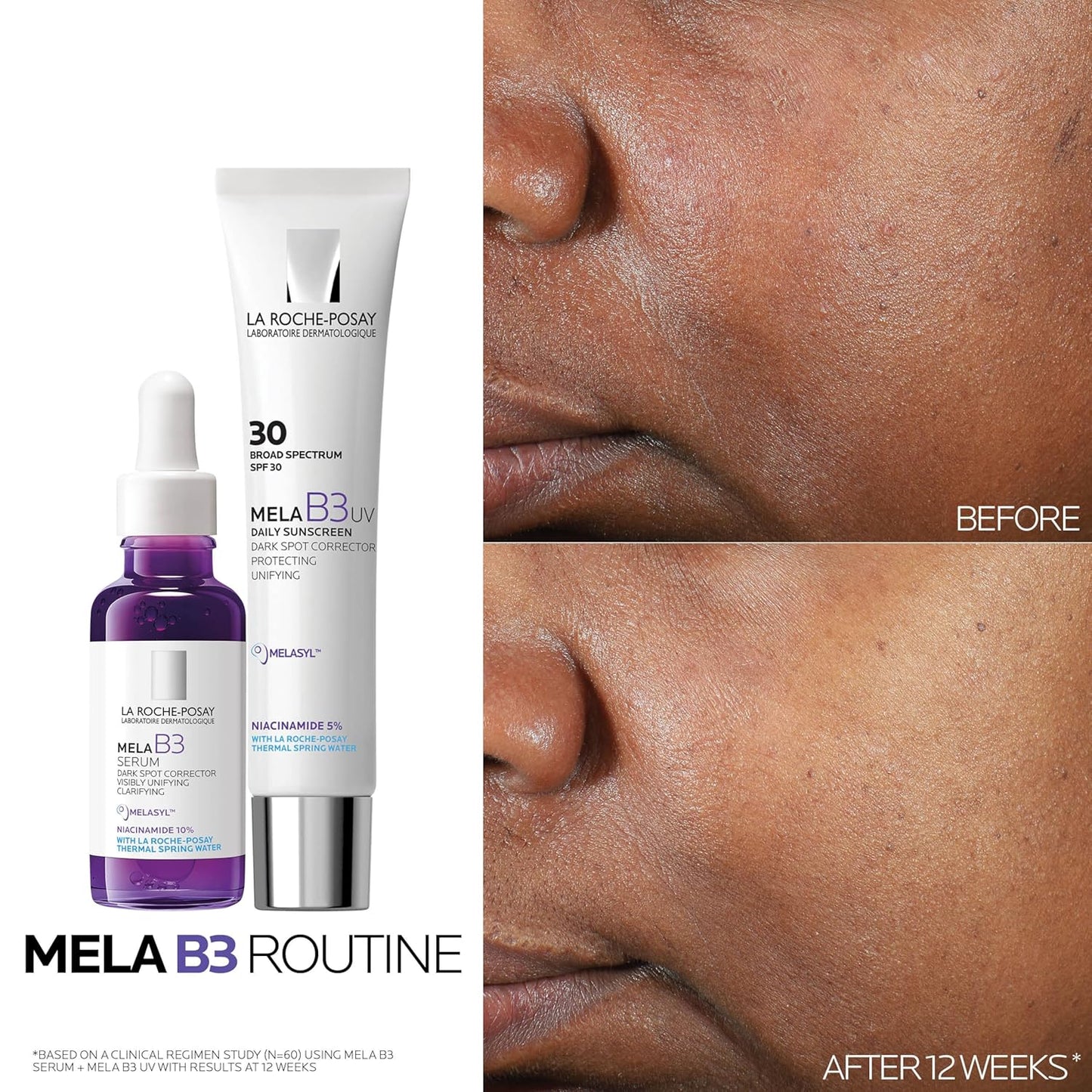La_Roche-Posay_Mela_B3_UV_Daily_Sunscreen,_Face_Moisturizer_With_SPF_30_+_Anti-Aging_Melasyl_+_5%_Niacinamide,_Helps_Correct_&_Protect_From_Sun_Damage,_Face_Sunscreen_With_No_White_Cast,_40ML