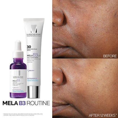 La_Roche-Posay_Mela_B3_UV_Daily_Sunscreen,_Face_Moisturizer_With_SPF_30_+_Anti-Aging_Melasyl_+_5%_Niacinamide,_Helps_Correct_&_Protect_From_Sun_Damage,_Face_Sunscreen_With_No_White_Cast,_40ML