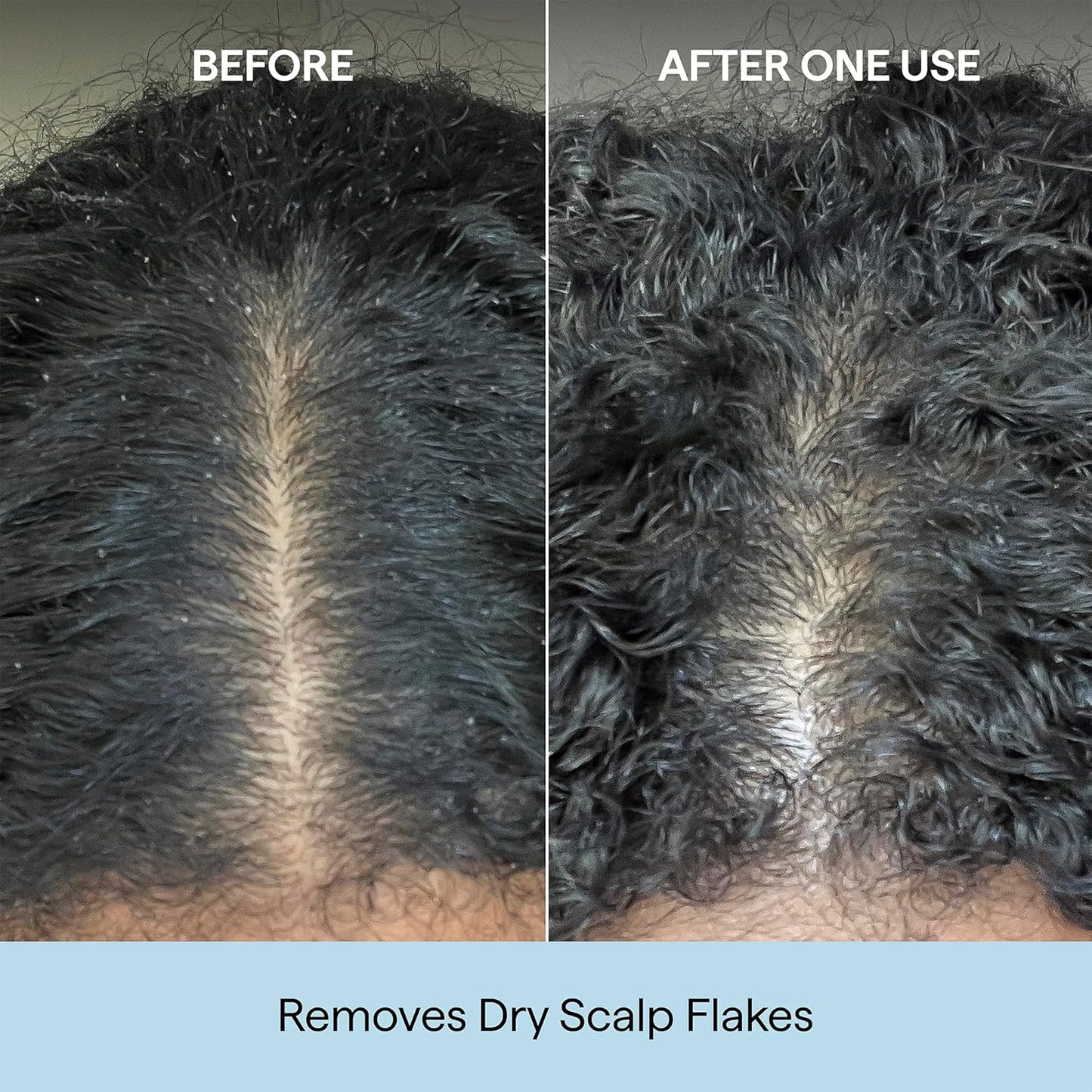 Briogeo_Scalp_Revival_Charcoal_+_Coconut_Oil_Micro-Exfoliating_Shampoo_|_Sulfate-Free_Scalp_Scrub_for_Dry,_Itchy,_or_Oily_Scalp_|_Detoxifying_&_Hydrating_|_Vegan_&_Cruelty_Free