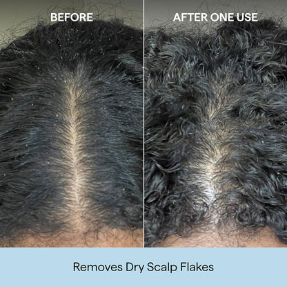 Briogeo_Scalp_Revival_Charcoal_+_Coconut_Oil_Micro-Exfoliating_Shampoo_|_Sulfate-Free_Scalp_Scrub_for_Dry,_Itchy,_or_Oily_Scalp_|_Detoxifying_&_Hydrating_|_Vegan_&_Cruelty_Free