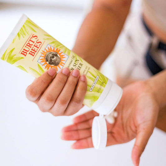 Burt's_Bees_After_Sun_Lotion_with_Hydrating_Aloe_Vera_&_Coconut_Oil_-_Summer_Essentials,_Sunburn_Relief,_Natural_After_Sun_Soother,_6_oz