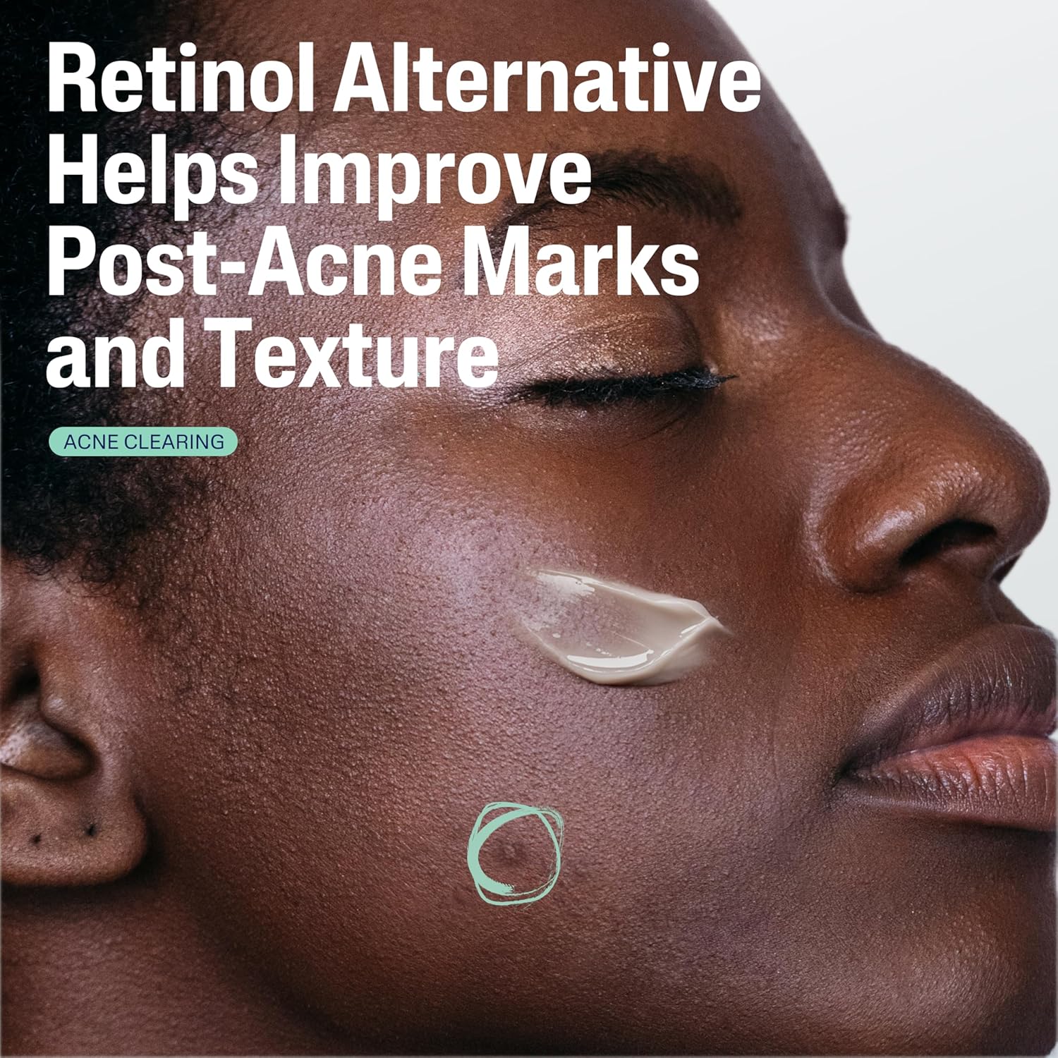 CETAPHIL_Gentle_Clear_Repairing_Post-Acne_Serum,_Retinol_Alternative,_Oil_Free_Serum_for_Sensitive_Skin,_1_Fl_Oz,_Bakuchiol,_Improves_Skin_Tone_&_Post-acne_Marks,_Dermatologist_Recommended_Brand