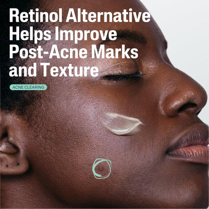 CETAPHIL_Gentle_Clear_Repairing_Post-Acne_Serum,_Retinol_Alternative,_Oil_Free_Serum_for_Sensitive_Skin,_1_Fl_Oz,_Bakuchiol,_Improves_Skin_Tone_&_Post-acne_Marks,_Dermatologist_Recommended_Brand