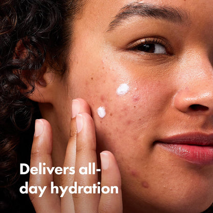 Hero_Cosmetics_Rescue_Balm_(New_Formula)-The_Post-Blemish_Cream_to_Boost_Hydration_and_Improve_the_Look_of_Post-Blemish_Marks._Derm-Tested._New_Formula._Won’t_Clog_Pores._15mL